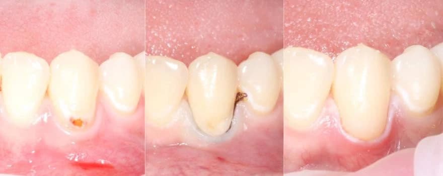 Реставрация зубов: форма и цвет