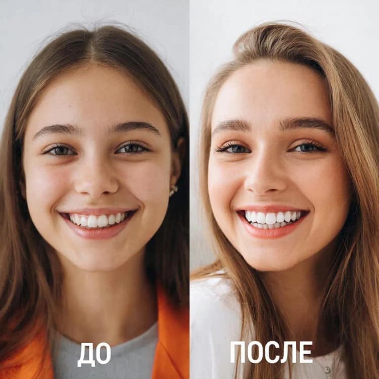 отбеливание Opalescence