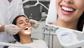 Результат кабинетного отбеливания