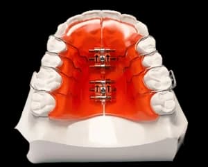 Аппарат Хааса