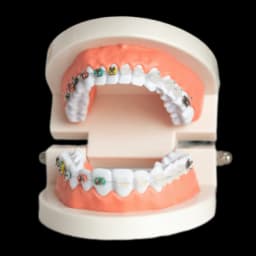 Брекеты на зубах