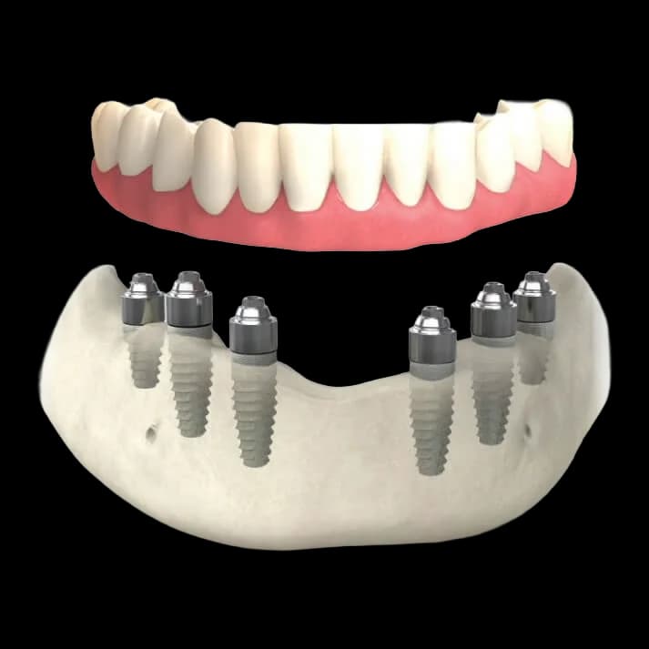система все на шести