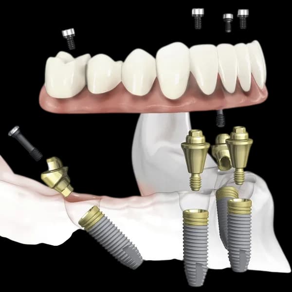 Здоровая улыбка и уход за полостью рта