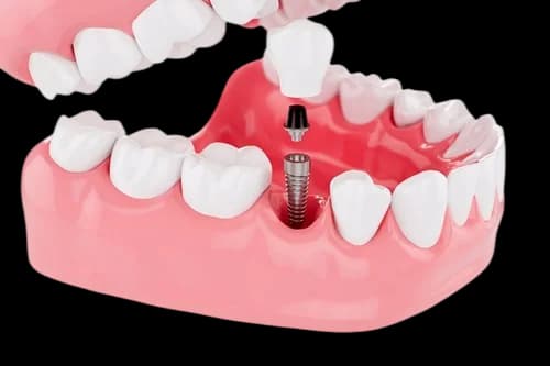 установка день в день