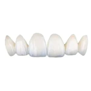 Керамическая коронка E-max