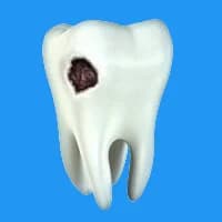 Дырка в зубе