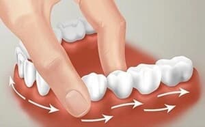 Подвижные зубы