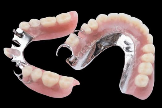 Бюгельный протез