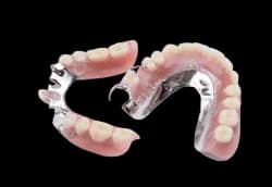 Бюгельный частичный протез