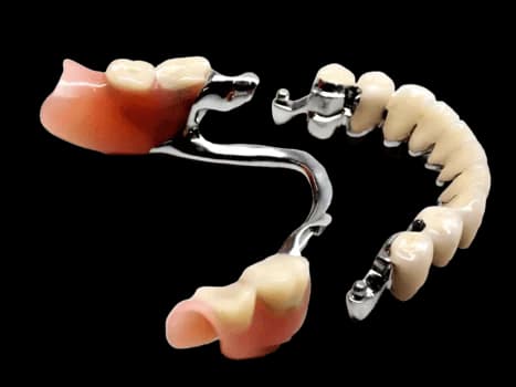 Бюгельный протез