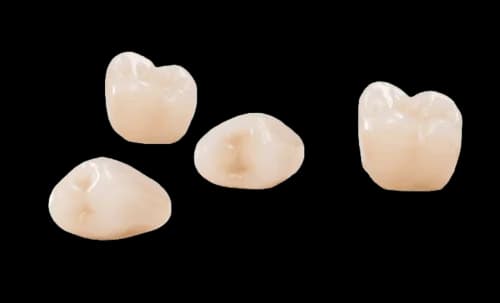 Коронка на зуб