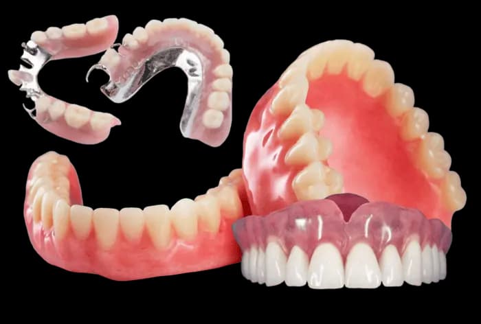 съемные протезы на зубы