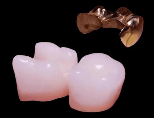 Металлическая вкладка