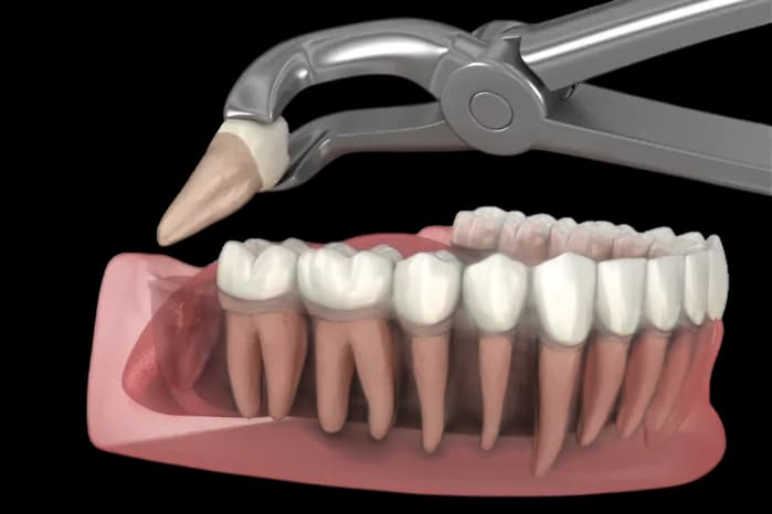Здоровая улыбка и уход за полостью рта