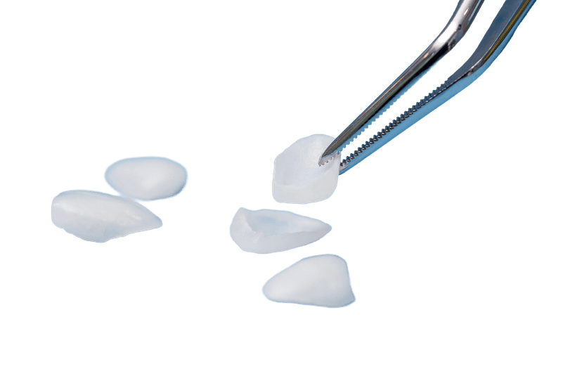 микропротезирование