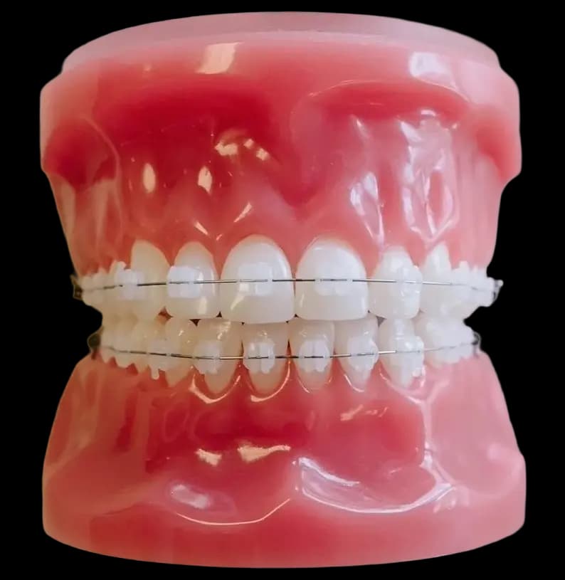 Несъемные способы