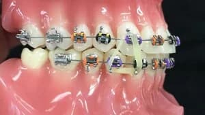 Настройка и активация