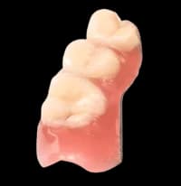 Сравнение типов протезов