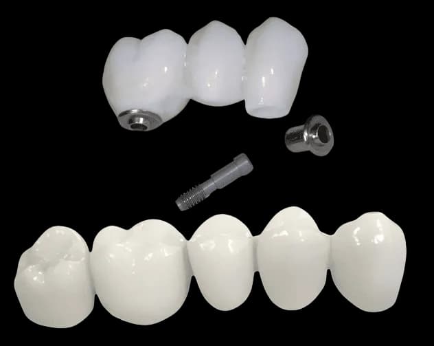 Мост из диоксида циркония