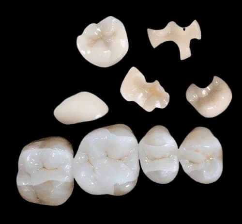 вкладка для зуба